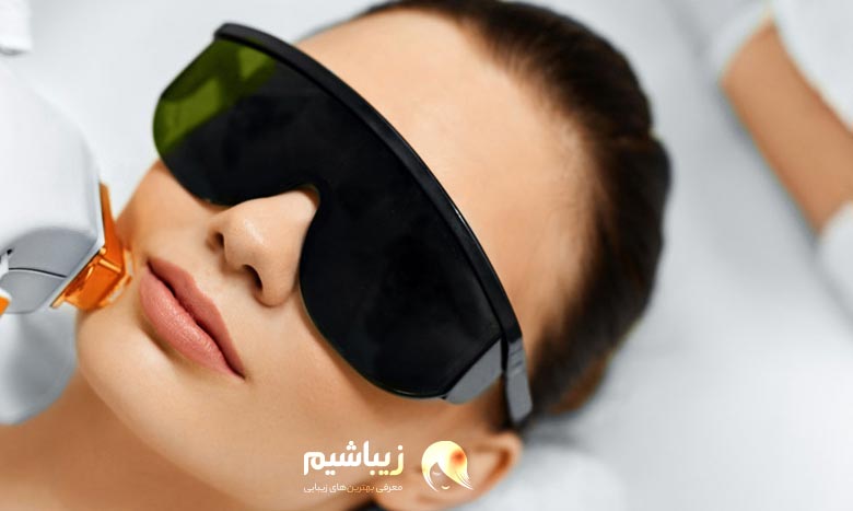 لیزر موهای زائد صورت و مزایای آن 3 عوارض لیزر موهای زائد صورت چیست؟