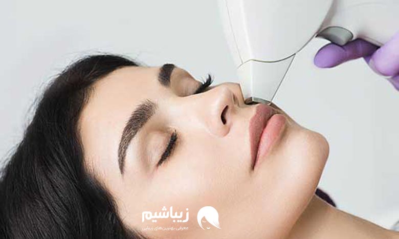 بهترین مرکز لیزر در لویزان 2 هزینه بهترین مرکز لیزر در لویزان