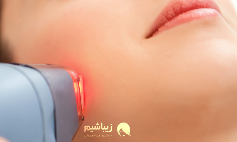 بهترین مرکز لیزر در سعادت آباد ۱۴۰۴ 2 نکات انتخاب بهترین مرکز لیزر در سعادت آباد