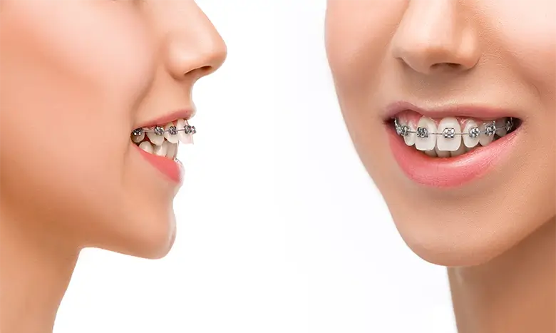 مقایسه متخصص ارتودنسی و دندانپزشک عمومی
