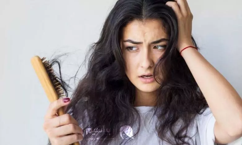 کاشت مو یا پیوند طبیعی مو چیست؟